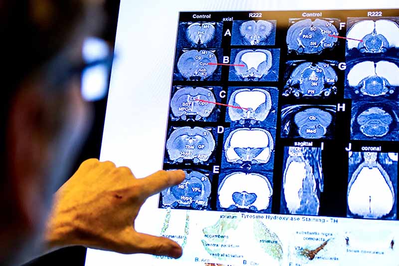 computer screen from lab with brain images